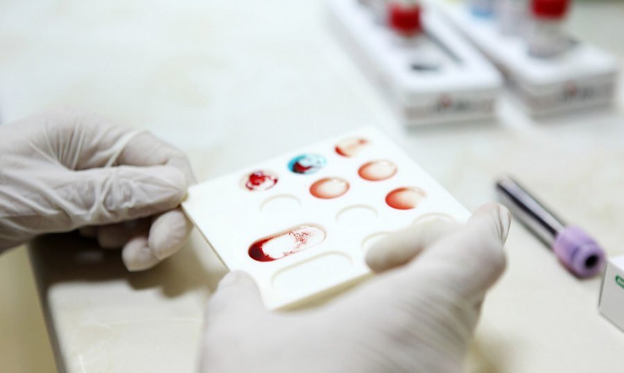 Covid-19: Anvisa livera testes rápidos em farmácias